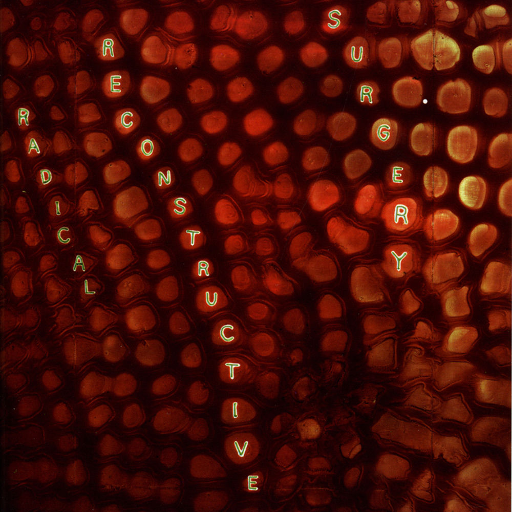 Scotty Hard's Radical Reconstructive Surgery cover
