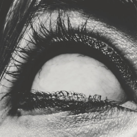 Pinned cover