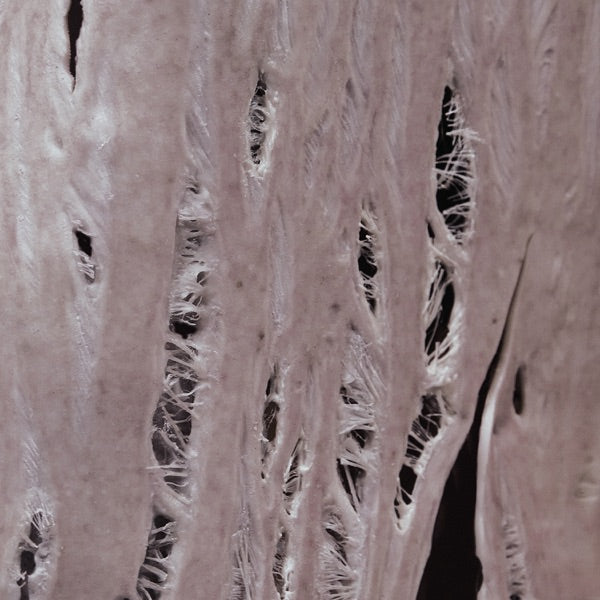 Torn cover