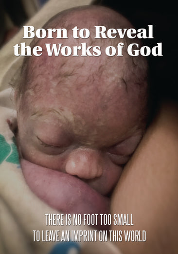 Born to Reveal the Works of God